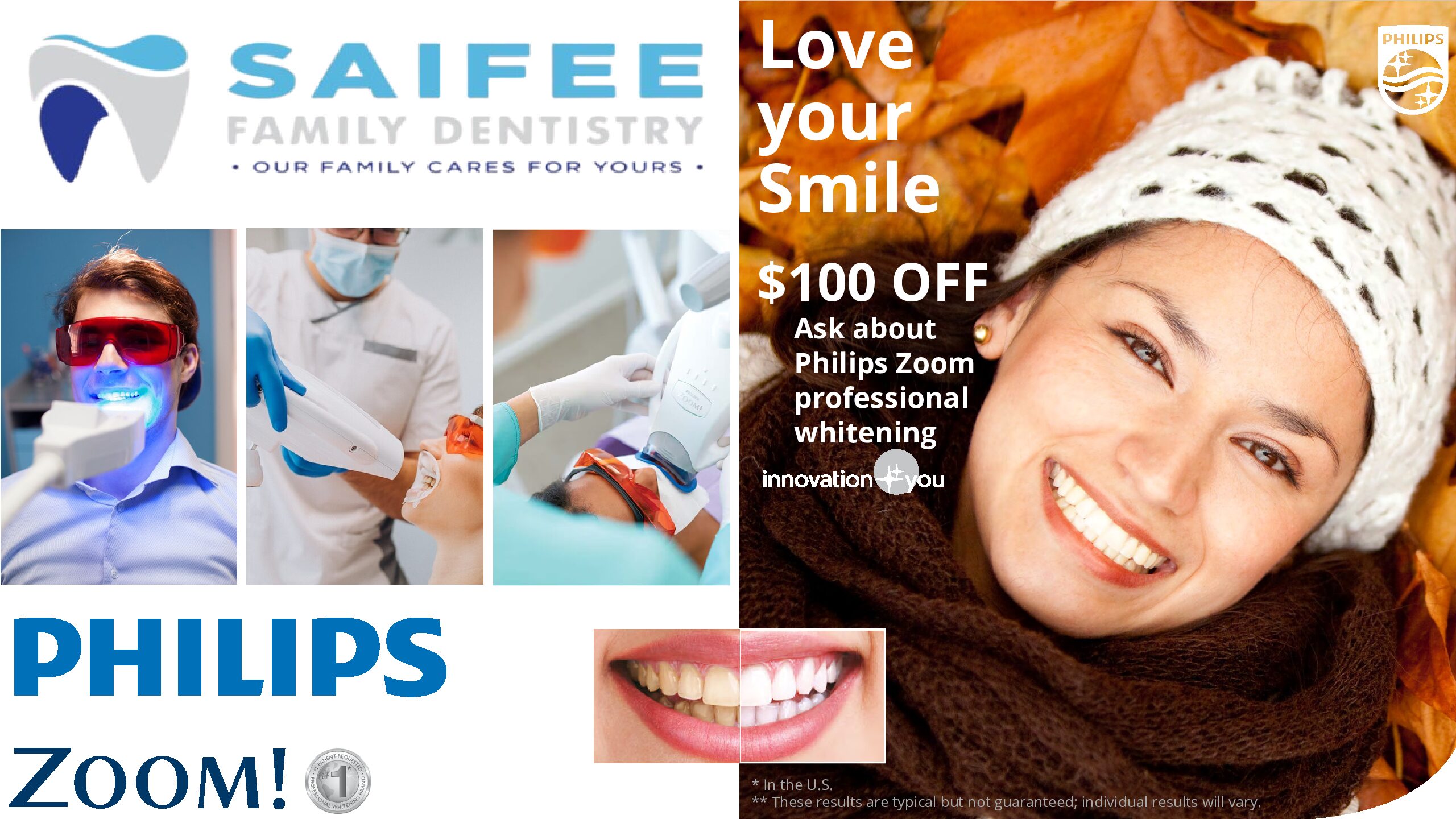 Saifee (2) Zoom Teeth Whitening